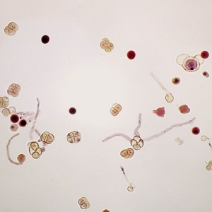 화분관 발아 (슬라이드 표본)